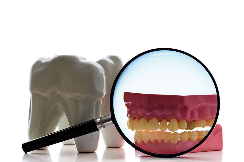 Root Canal in Chesterfield